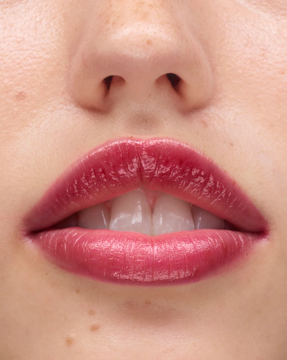 Ultralip - Image 58